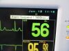 FUKUDA DENSHI 2010  DS-7210/DS-7200 Dynascope Monitor