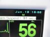 FUKUDA DENSHI 2010 Dynascope  DS-7200 Monitor