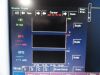 FUKUDA DENSHI 2010 Dynascope  DS-7200 Monitor