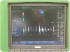 GE 8L-RS Ultrasound Transducer Probe