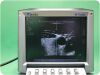 SONOSITE M-Turbo  Portable Ultrasound Machine (Tested)