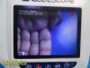 VERATHON Medical 0570-0304 Glidescope Cobalt AVL Monitor