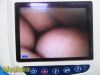 VERATHON Medical 0570-0304 Glidescope Cobalt AVL Monitor