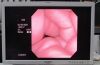 OLYMPUS ENF-VT2 Rhinolaryngoscope