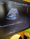 SAMSUNG WS80A OB/GYN with 4d options Ultrasound - OB / GYN - Vascular