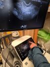 SAMSUNG WS80A OB/GYN with 4d options Ultrasound - OB / GYN - Vascular