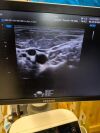 SAMSUNG WS80A OB/GYN with 4d options Ultrasound - OB / GYN - Vascular