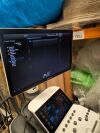 SAMSUNG WS80A OB/GYN with 4d options Ultrasound - OB / GYN - Vascular