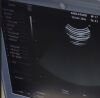 GE RAB2-5-RS Ultrasound Transducer