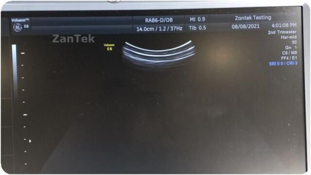 GE 2015  Voluson E6 Ultrasound BT13.5, HDLive, BT, 4D, DICOM, STIC, & more 2015 Voluson E6 Ultrasound BT13.5, HDLive, BT, 4D, DICOM, STIC, & more