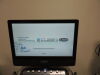 ALPINION E-Cube 9 Ultrasound - OB / GYN