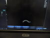 ALPINION E-Cube 9 Ultrasound - OB / GYN