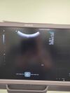SIEMENS/ACUSON 8C3 HD Ultrasound Transducer
