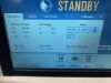 SIRIUSMED R30 Ventilator