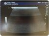 GE HEALTHCARE Healthcare ML6-15-D Ultrasound Probe