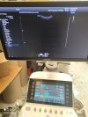 SAMSUNG ca1-7a Ultrasound Transducer