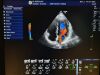 DIAGNOSTIC ULTRASOUND LOGIQ S8 Scanner