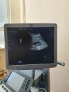 DIAGNOSTIC ULTRASOUND LOGIQ S8 Scanner