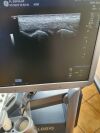 DIAGNOSTIC ULTRASOUND LOGIQ S8 Scanner