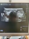 DIAGNOSTIC ULTRASOUND LOGIQ S8 Scanner