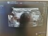 DIAGNOSTIC ULTRASOUND LOGIQ S8 Scanner