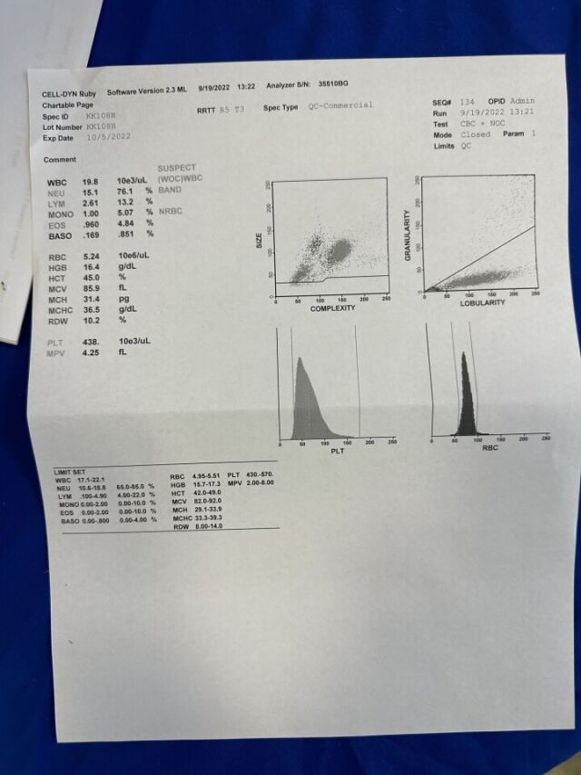 ABBOTT LABS CD-RUBY Hematology Analyzer