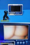 VERATHON Glidescope Portable GVL Monitor