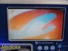 VERATHON Glidescope Portable GVL Monitor