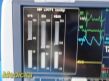 GE Dash 4000 Colored  (Masimo SpO2) W/ NEW Patient Leads ~ Patient Monitor