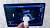 GE Logiq E9 xDclear 2.0 2018 year MSK - Musculoskeletal