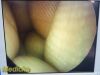 SMITH & NEPHEW DYONICS 7205922 Video Rigid Telescope 4mmx30Ã‚Â° (TESTED)