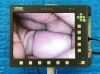 KARL STORZ Telepack X LED TP100 with camera head, light cable and USB Laparoscope