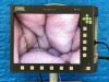 KARL STORZ Telepack X LED TP100 with camera head, light cable and USB Laparoscope