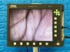 KARL STORZ Telepack X LED TP100 with camera head, light cable and USB Laparoscope
