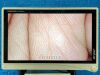 STRYKER 1488HD Tower complete 2017 Laparoscope