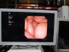 OLYMPUS URF-V2R Ureteroscope