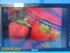SONY Olympus  LMD-2451MT 24" 3D HD Surgical Monitor