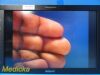 SONY Olympus  LMD-2451MT 24" 3D HD Surgical Monitor