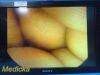 SMITH & NEPHEW 7208130 DYONICS 10mm x 0° Rigid Laparoscope