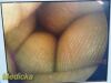 Listing 4687124