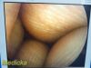Listing 4687124