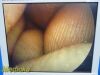 Listing 4687124