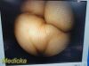 SMITH & NEPHEW 4126 DYONICS 4mm x 70° Video Arthroscope Rigid Telescope