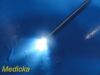 SMITH & NEPHEW ACUFEX DYONICS 7207951 Smith & Nephew ACUFEX DYONICS 7207951 Laparoscope