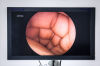 SMITH & NEPHEW 660HD 500XL Endoscope