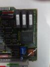 SIEMENS 87 14 651 x1993 Siremobil C-Arm