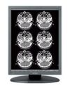 JVC TOTOKU 253i2 Monochrome LCD Display Medical Monitor -