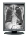 TOTOKU MS33i2 Monitor