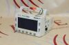 WELCH ALLYN N/A Bedside Monitor