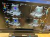 CANON Toshiba I900 Ultrasound - Cardiac - Vascular